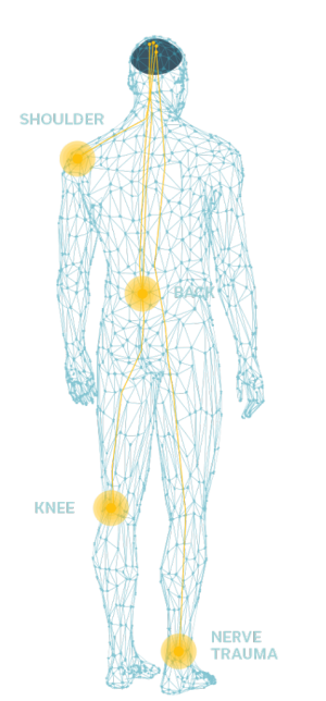Body Diagram of Nerves