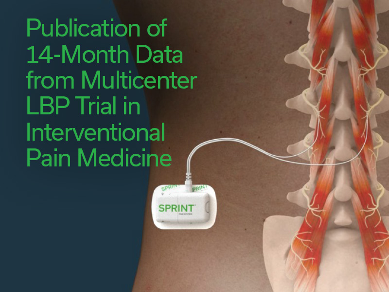 Publication of 14-Month Data from Multicenter LBP Trial in Interventional Pain Medicine